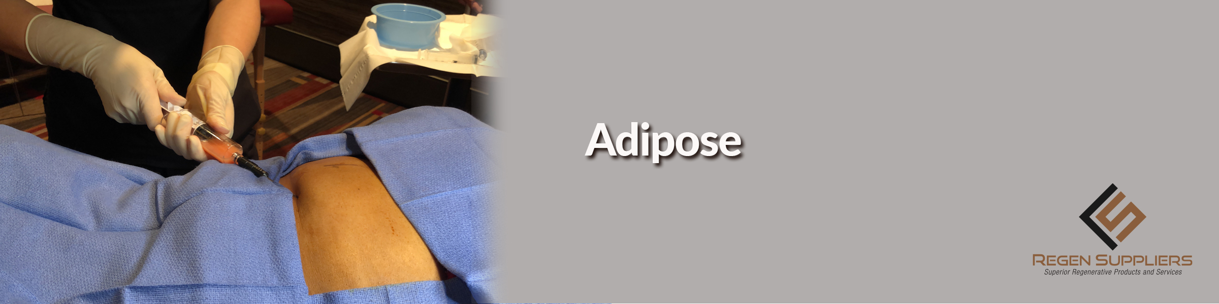 Adipose