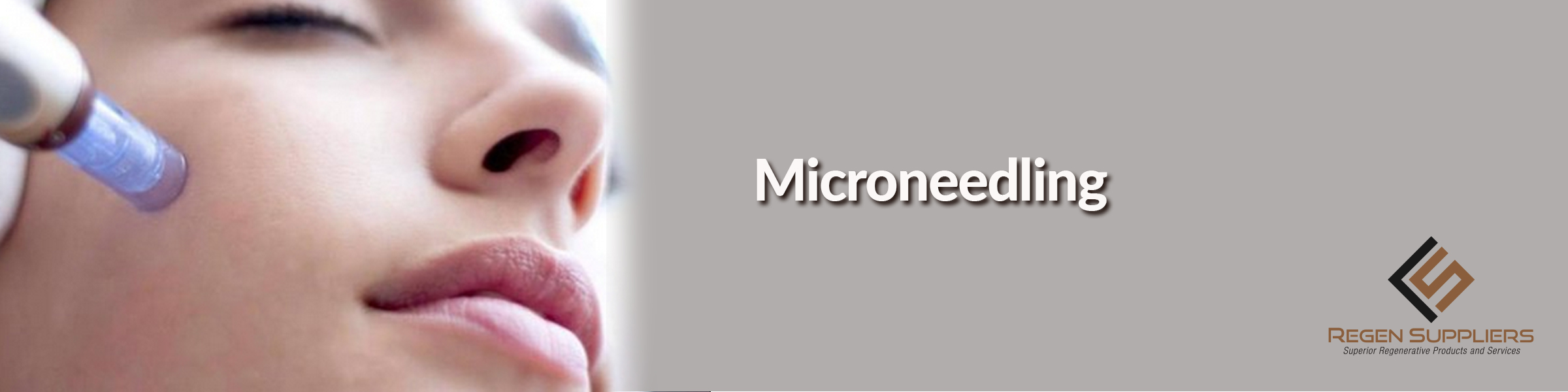 Microneedling