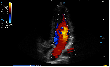 SonoScape E2 Pro Ultrasound