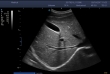 SonoScape E2 Pro Ultrasound