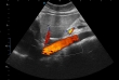 SonoScape E2 Pro Ultrasound