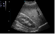 SonoScape E2 Pro Ultrasound