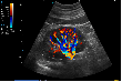 SonoScape E2 Pro Ultrasound